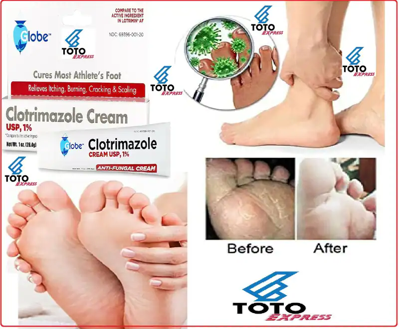 Crema Pomada Crema Pomadas para Los Hongos Hongo Ongos Tratamiento Antihongos ys